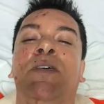 Cantor gospel Regis Danese grava vídeo e dá detalhes do acidente: 'estou à base de morfina'