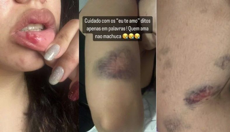 Cantora gospel relata agressões de namorado lutador de MMA: ‘Tentou me matar’
