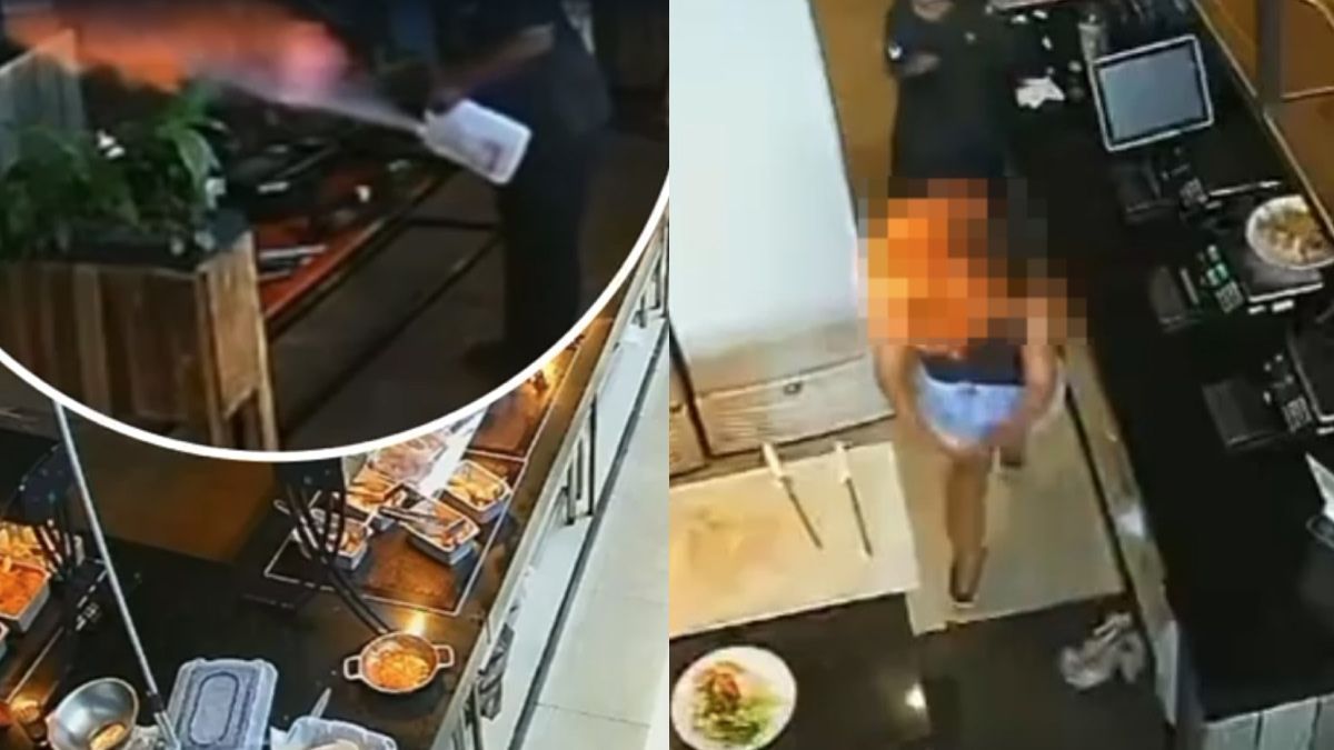 Mulher que teve o cabelo incendiado em restaurante de BH terá que passar por cirurgia