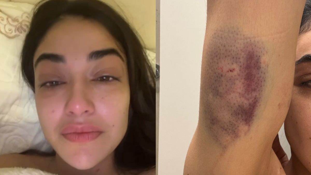 Justiça concede medida protetiva a empresária agredida pelo namorado em Nova Lima