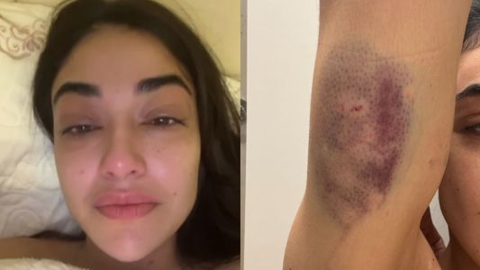 Justiça concede medida protetiva a empresária agredida por namorado em Nova Lima