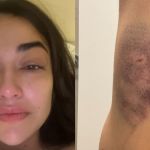 Justiça concede medida protetiva a empresária agredida pelo namorado em Nova Lima