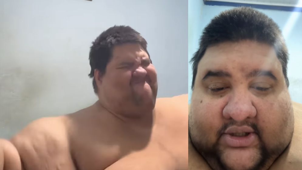 Morre aos 37 anos influenciador que compartilhava luta contra a obesidade mórbida