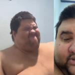 Morre aos 37 anos influenciador que compartilhava luta contra a obesidade mórbida
