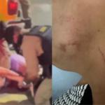 Mulher denuncia agressões em abordagem policial violenta na Grande BH: 'Muito medo'