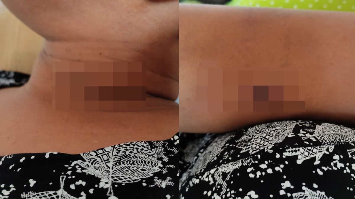 Filha dá paulada na cabeça de agressor e salva mãe de feminicídio em Vespasiano
