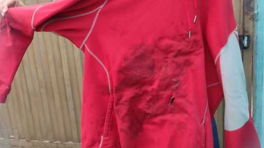Viúva de morto em briga de bar em Contagem revela o que aconteceu antes do crime
