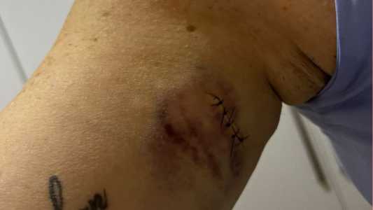 'Deus me ressuscitou', diz vítima de tentativa de feminicídio no Natal em BH