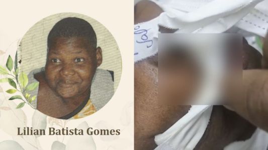 Mulher que morreu após ser infestada por larvas em hospital de BH será velada nesta terça