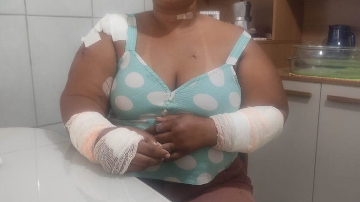 Mulher sobrevive após ser esfaqueada mais de 40 vezes na Grande BH: 'Segunda vida'