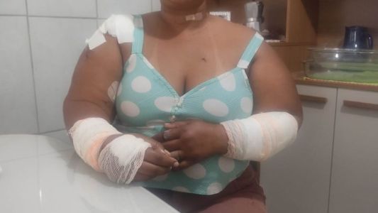 Mulher sobrevive após ser esfaqueada mais de 40 vezes na Grande BH: 'Segunda vida'