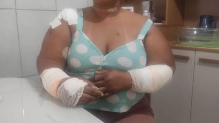 Mulher sobrevive após ser esfaqueada mais de 40 vezes na Grande BH: 'Segunda vida'