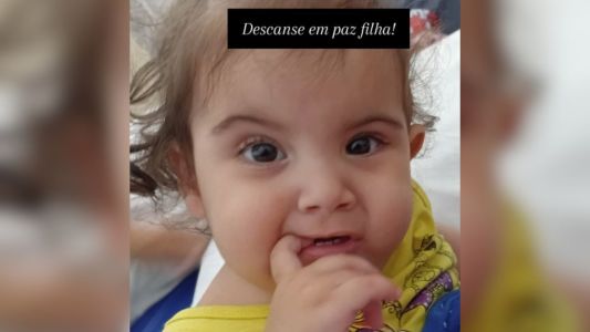 Gêmea siamesa morreu