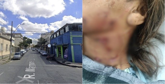 Idosa é atacada por cachorro no bairro Santa Tereza em BH: 'achei que ia morrer'