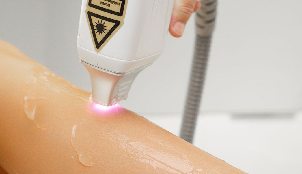Clínica de depilação a laser de BH é condenada a indenizar cliente que teve as pernas queimadas