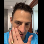 Lateral do Bahia mostra rosto machucado após lance que expulsou Gregore, do Botafogo