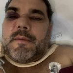 Flamenguista espancado por atleticanos em BH se prepara para cirurgia e anuncia decisão