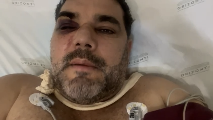Flamenguista agrdido por atleticanos se recupera de fraturas no rosto, lesão no olho e traumatismo craniano no CTI