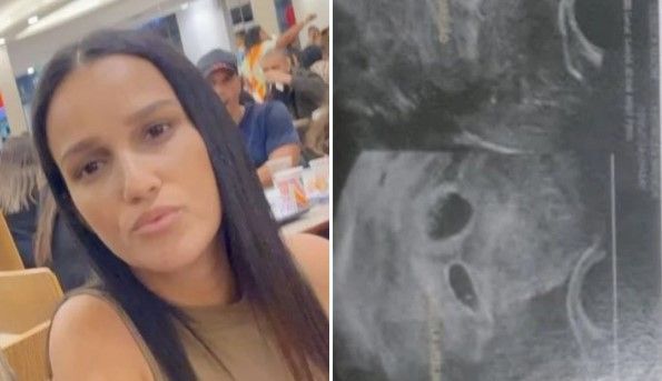 Hospital no Rio diz que avisou grávida de gêmeos que poderia ser só um bebê, mas família nega