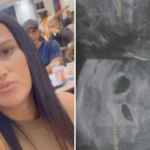 Hospital no Rio diz que avisou grávida de gêmeos que poderia ser só um bebê, mas família nega