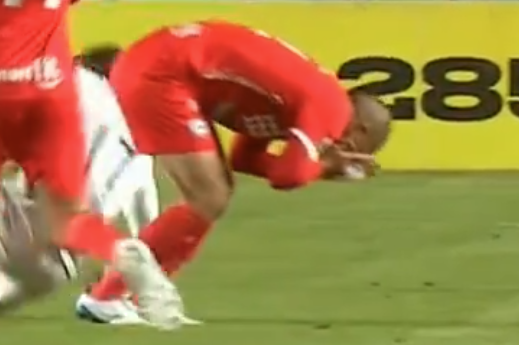 Jogador de rival do Atlético na 'Sula' leva cotovelada e perde três dentes; assista