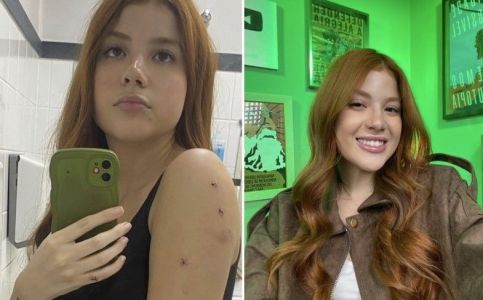 Influenciadora mostrou marcas da agressão nas redes sociais