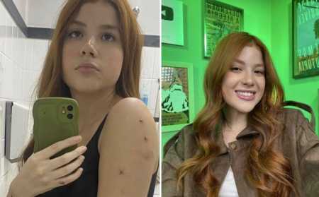 Influenciadora mostrou marcas da agressão nas redes sociais