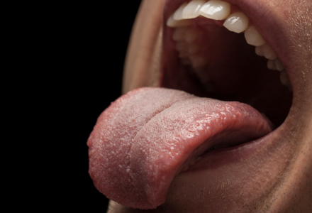 Biossensor identifica na saliva proteína ligada à depressão e esquizofrenia