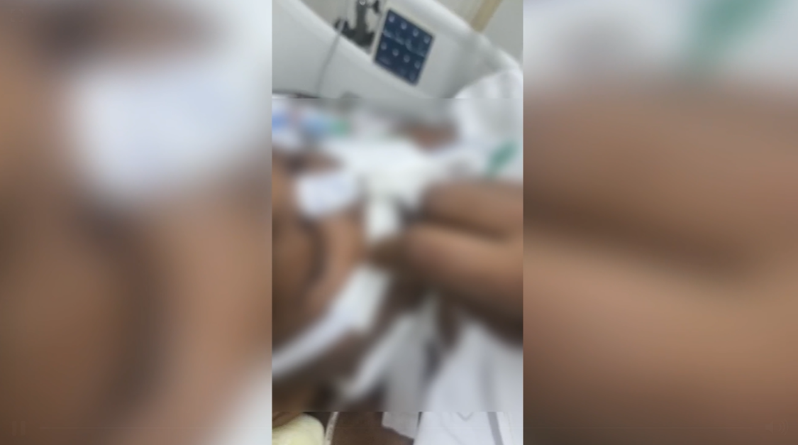 Paciente morre após família denunciar larvas em CTI do Hospital Odilon Behrens, em BH