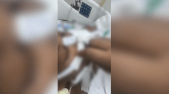 Larvas sob os curativos da paciente no Hospital Metropolitano Odilon Behrens, em Belo Horizonte