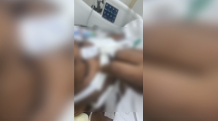 Larvas sob os curativos da paciente no Hospital Metropolitano Odilon Behrens, em Belo Horizonte