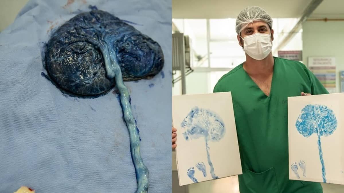 Carimbo com placenta: pediatra mineiro  faz arte para preservar memória da gestação; veja imagens