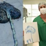 Carimbo com placenta: pediatra mineiro  faz arte para preservar memória da gestação; veja imagens