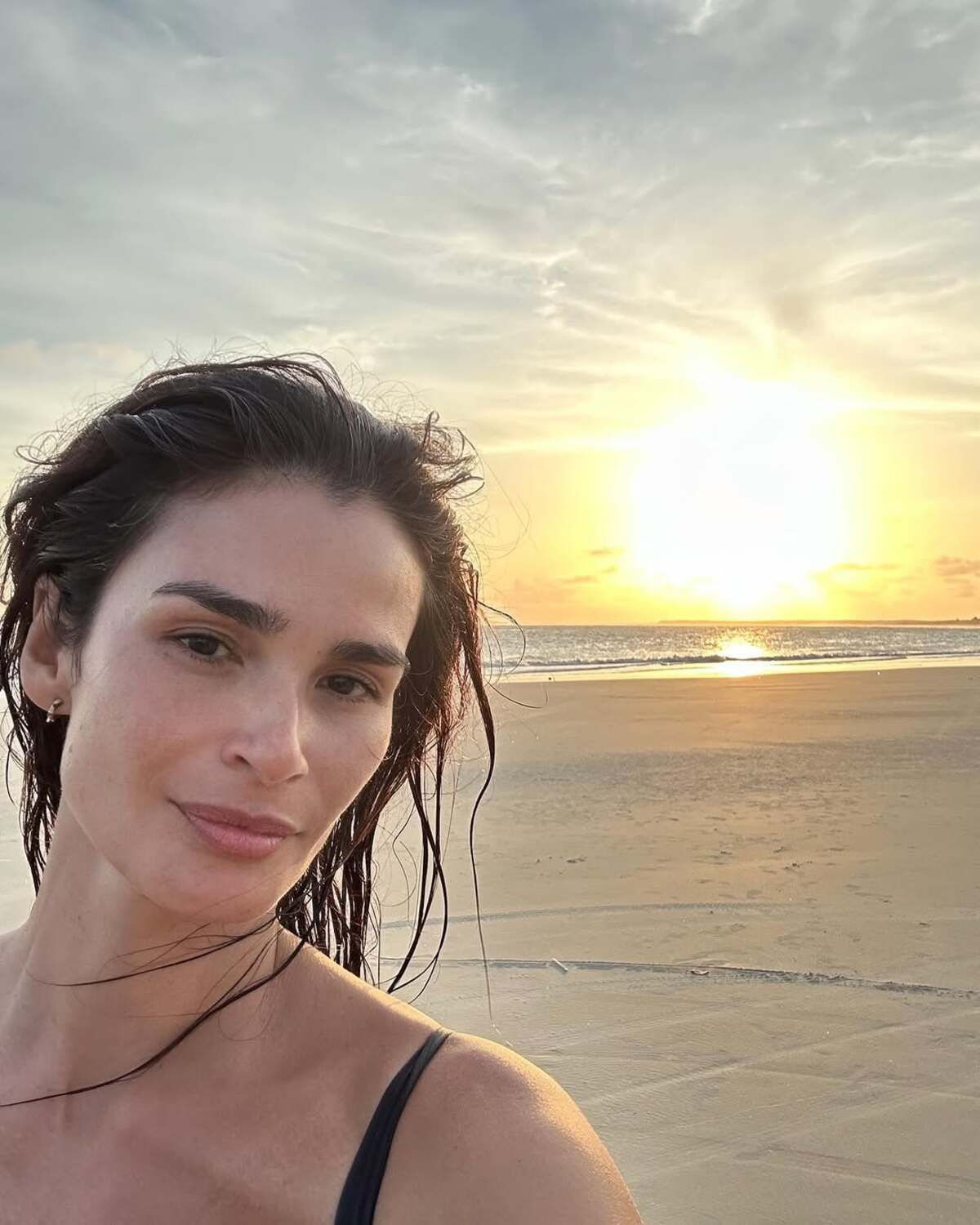 Modelo Carol Ribeiro é diagnosticada com esclerose múltipla