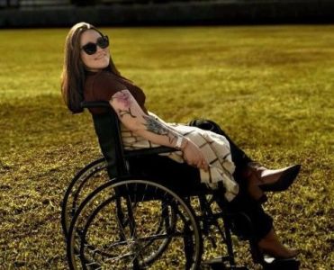 Carolina Arruda, de 28 anos, que sofre com neuralgia do trigêmeo, que é conhecido como ‘a pior dor do mundo’