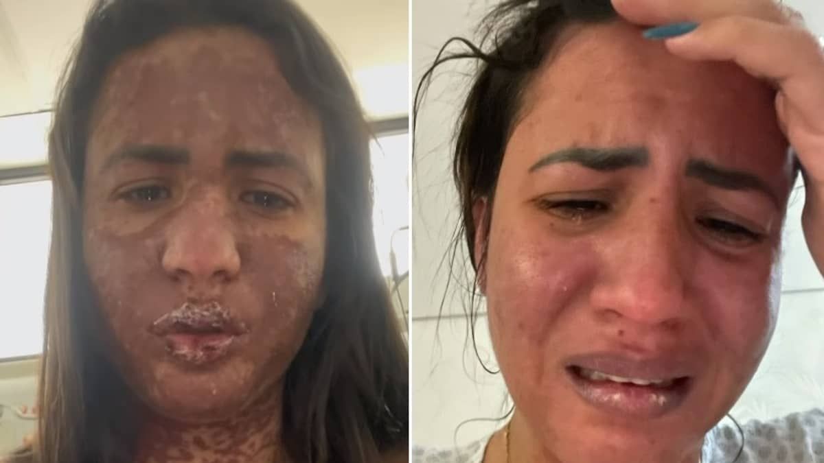 Esposa de Frank Aguiar revela que quase morreu após diagnóstico de doença rara
