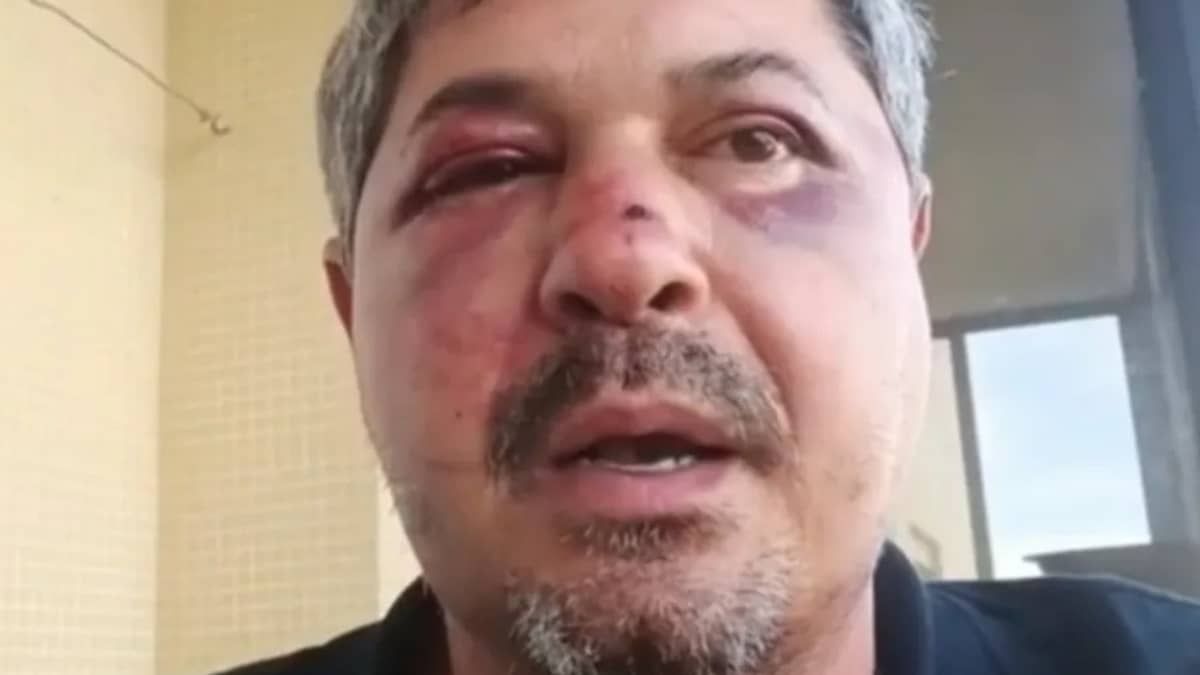 Vítima de xenofobia, brasileiro  é espancado por homem em Portugal