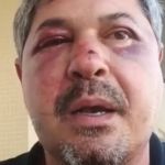 Vítima de xenofobia, brasileiro  é espancado por homem em Portugal