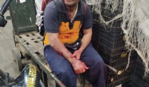 Um homem de 40 anos, trabalhador da Ceasa Minas, terminou preso depois de tentar matar um colega, de 47 anos