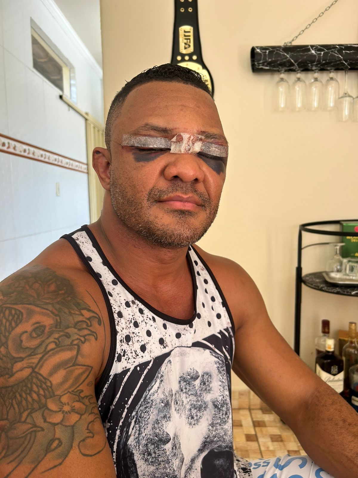 Guarda de BH que quase ficou cego ao ser atingido por linha com cerol leva 28 pontos