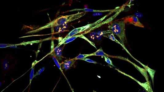 Cientistas transformam células cancerígenas em unidades musculares saudáveis.