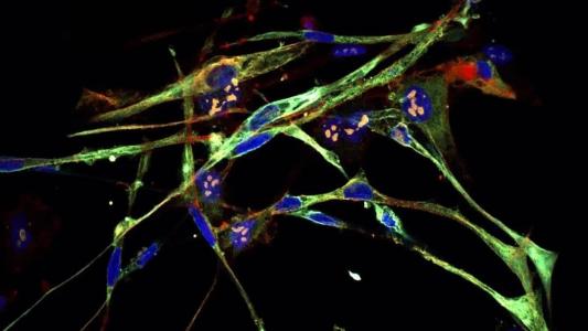 Cientistas transformam células cancerígenas em unidades musculares saudáveis.
