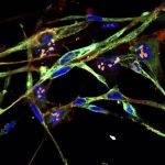 Cientistas transformam células cancerígenas em unidades musculares saudáveis