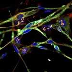 Cientistas transformam células cancerígenas em unidades musculares saudáveis
