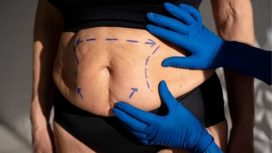 Cirurgia plástica