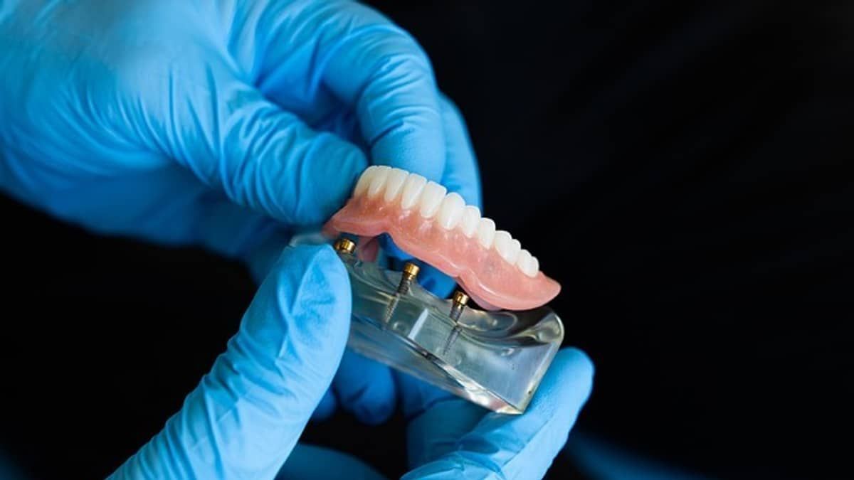 Justiça manda município pagar dentadura e indenizar ciclista que caiu em buraco