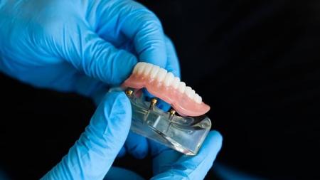 Cliente que perdeu os dentes vai ganhar dentadura