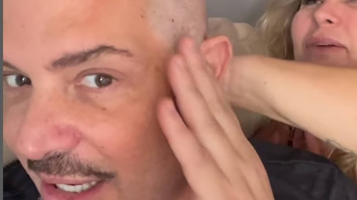 Com câncer no reto, Conrado raspa o cabelo após início da quimioterapia