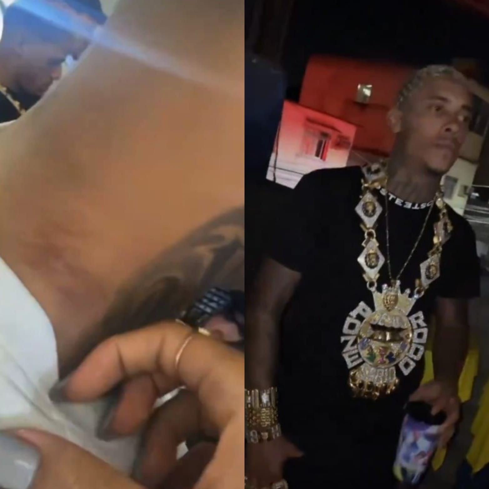 Cordão de ouro e diamante de 2kg deixa MC Poze com hematomas no pescoço