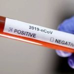 Saúde: estudo italiano revela 'mistérios' da Covid prolongada